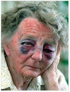 Ethel Kyte, 81, after Aaron Rhys McDonald bashed her on Christmas Day in 1997 (Stuff.co.nz)