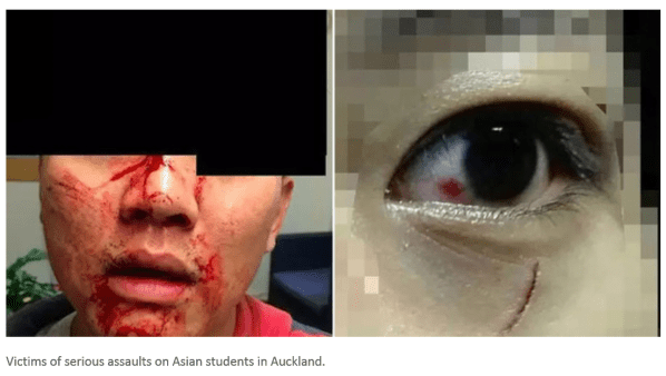 Asian students attacks by auckland gangs